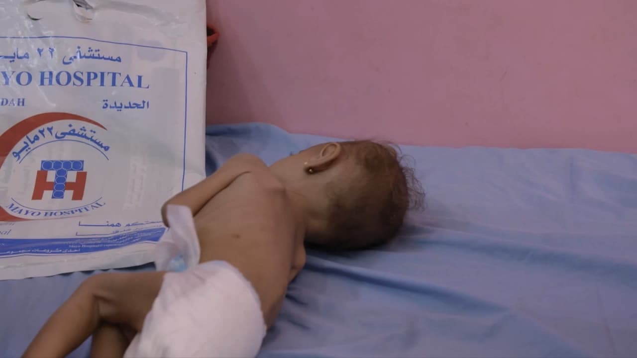 A Living Hell in YemenMDMA for PTSD