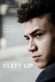 Cleft Lip' Poster