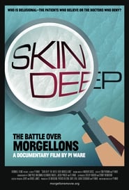 Skin Deep The Battle Over Morgellons' Poster