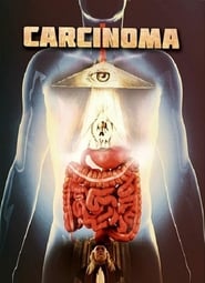 Carcinoma' Poster