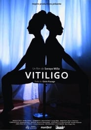 Vitiligo' Poster