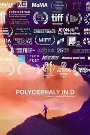 Polycephaly in D' Poster