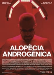 Androgenic Alopecia' Poster