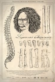 Luzonensis osteoporosis' Poster