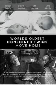 Worlds Oldest Conjoined Twins Move Home' Poster