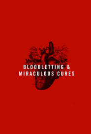 Bloodletting  Miraculous Cures