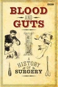 Blood and Guts A History of Surgery' Poster