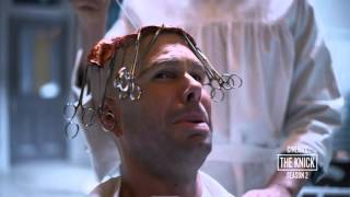 The Knick Season 2 Body Shop  Brain Surgery Cinemax