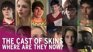 Skins  Where Are They Now