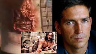 The Passion of the Christ  6 Injuries suffered by Jim Caviezel during filming