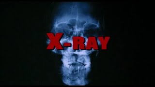 XRay 1981 aka Hospital Massacre  promo spot trailer  Barbi Benton
