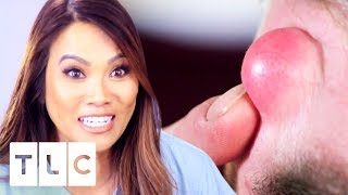 Brand New Dr Pimple Popper  26th July At 9pm On TLC UK