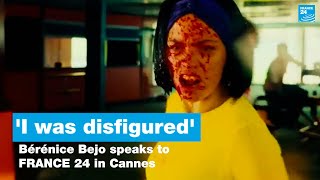 I was disfigured Brnice Bejo of Final Cut tells FRANCE 24 in Cannes  FRANCE 24