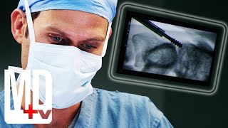 Fusing Vertebrae with a Screw In Risky Surgery  Do No Harm  MD TV