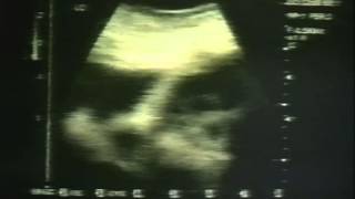 Progeny Trailer 1998