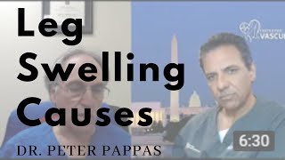 Leg Swelling Causes Explained by Dr Peter Pappas