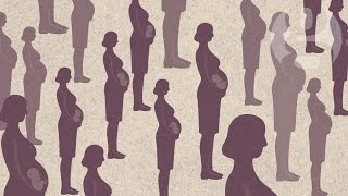 Why do women still die in childbirth Emily Watson  Guardian Animations