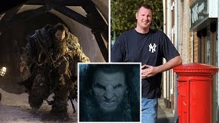 Neil Fingleton  Britains tallest man at 7ft 7in dles of heart failure