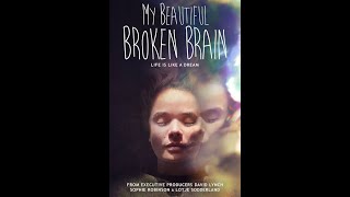 My Beautiful Broken Brain 2014 Documentary