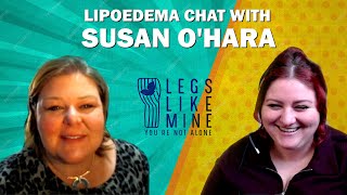 Susan OHara legslikemine about lipoedema footwear Lipoedema World Congress  our love of bread