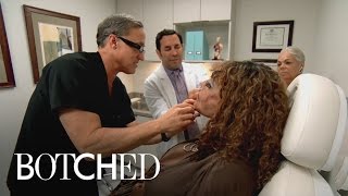 Terry Dubrow Hatches Plan to Take on CementInjected Face  Botched  E